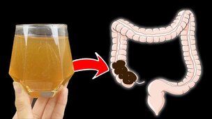 Nyeri dan wasir? Perawatan tanpa operasi, buatan sendiri!
