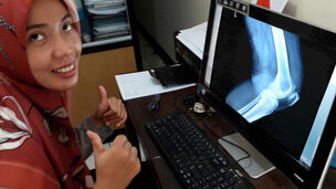 Rahasia atasi nyeri & keausan sendi: Minum ini di pagi hari!